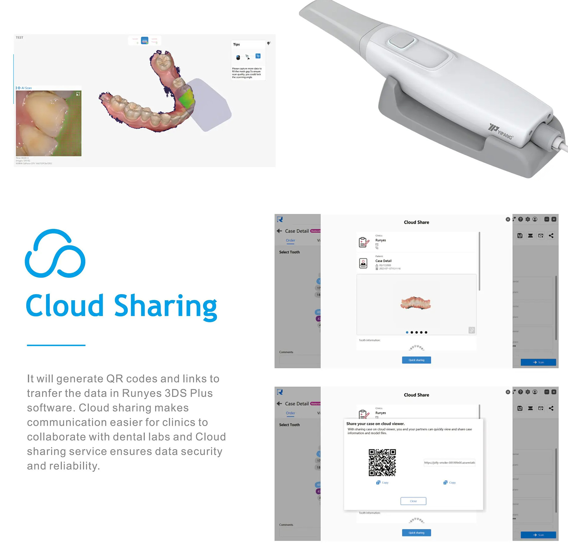 YP-11 Dental 3D Intraoral Scanner with Color Scanning for Restorative, Implant and Orthodontic